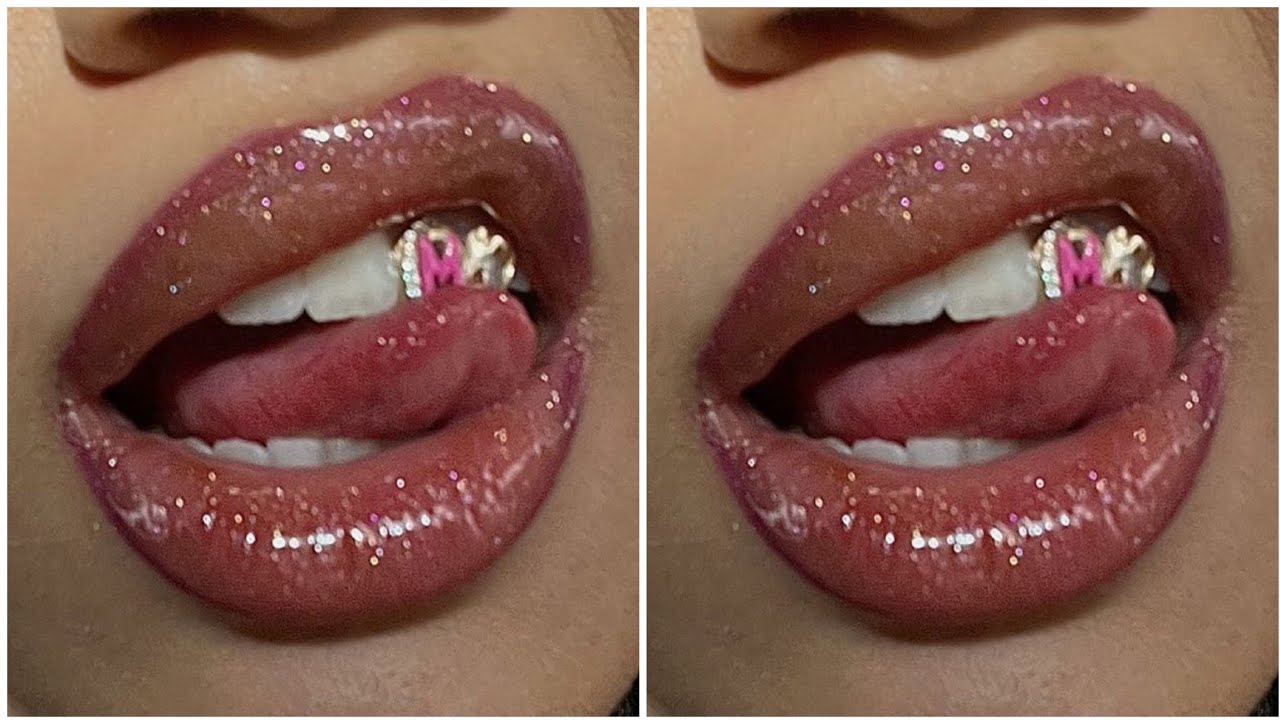 كومبو الأسنان الخارق “بروتوكول الطاقي للهوليود سمايل ترتيب، بياض، تجديد