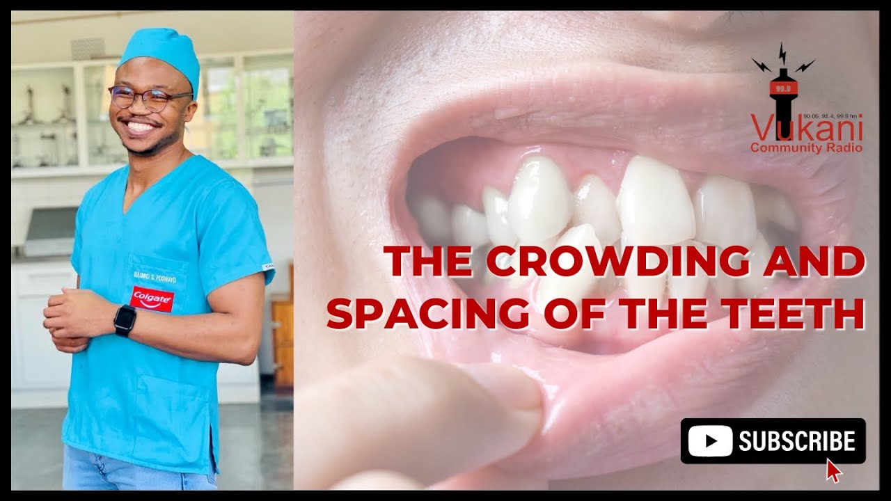 The Crowding and Spacing of the Teeth | Dr Bulumko Poswayo