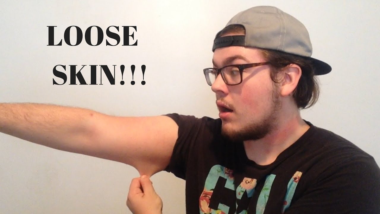 Does Water Fasting Cause Loose Skin??? How To Get Rid Of Loose Skin!!! YouTube