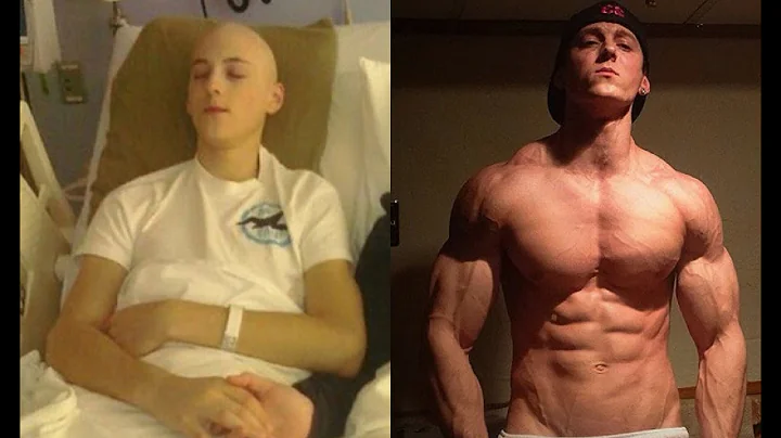 The Zach Zeiler Transformation