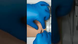 Fine slicing our way through Saturday #Surgery #surgicalskills #medtutor #plasticsurgery #doctor