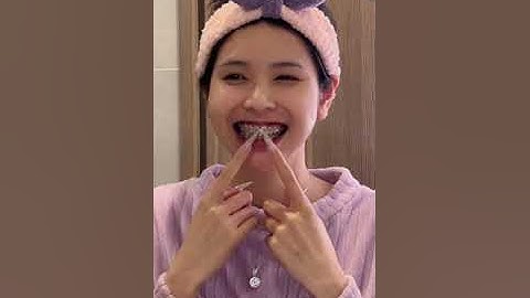 Cách vệ sinh răng sau ăn khi niềng răng