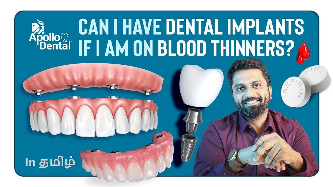Can I have Dental Implants If I am on Blood Thinners? YouTube