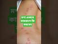 শুধু মেয়ে মশা কেন কামড়ায় চমকপ্রদ সত্য! #trending #মশা #amazingfacts