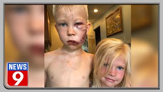 6-year-old boy saves sister from dog attack!