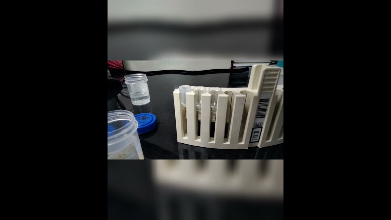 DAILY CLEAN MAINTENANCE OF Beckman Coulter Access 2 YouTube