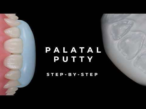 How to Make a Palatal Putty Index | Step-by-Step Guide