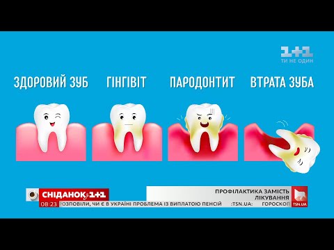 Video: Zavjera Stomatologa? Cavemenovi Zubi Izgledali Su Bolje Bez Paste Za Zube - Alternativni Prikaz