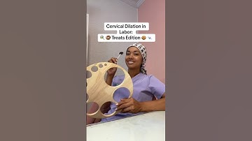 Cervical Dilation in Labor: Treats Edition #shorts