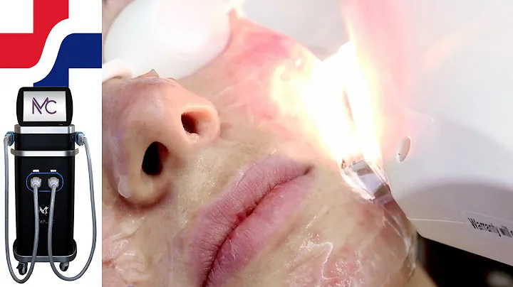 Intense Pulsed Light for Hair Removal and Skin Rejuvenation - The MediLight