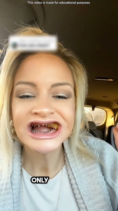 The Truth Behind Her Fake Smile 😯