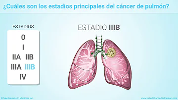 ¿Qué tamaño de tumor corresponde al estadio 3?