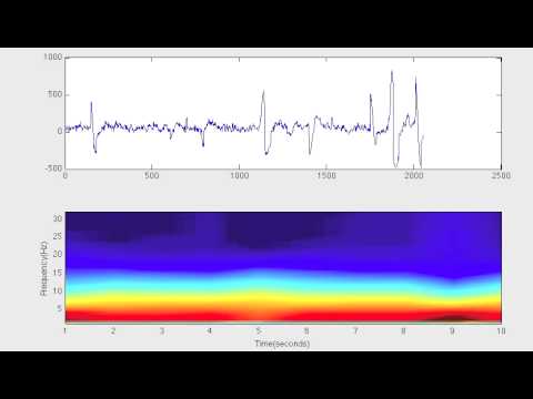 Neuroskyrealtime.mov