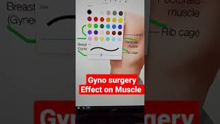 Gyno Surgery And Effects on Muscle #short