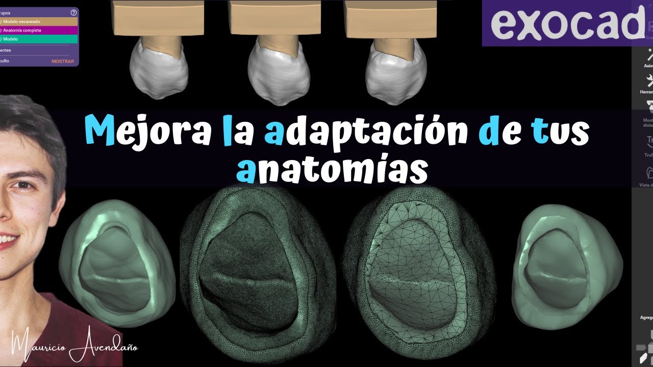 Como mejorar la adaptación de anatomias en programas CAD nuevo protocolo💥 [Mauricio Avendaño]