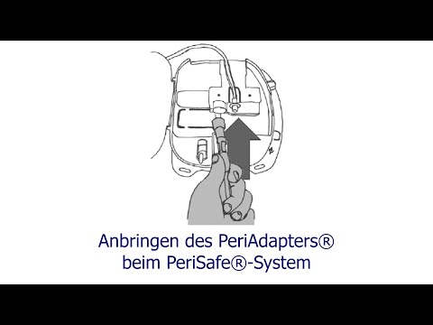 Anbringen des PeriAdapters® beim PeriSafe®-System ll DE