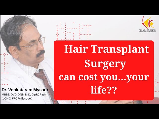 Death due to Hair transplantation surgery | How to be safe | Venkat Center