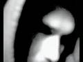 3tronik - Against Myself