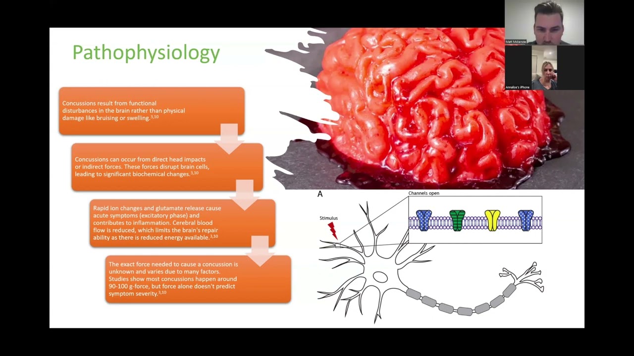 22000192 Summative Presentation Concussion Final