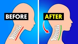 10 Simple Exercises That Will Fix Your Bad Neck Posture