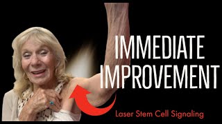 25% Improvement in Range of Motion Right after Procedure - Laser Stem Cell Signaling