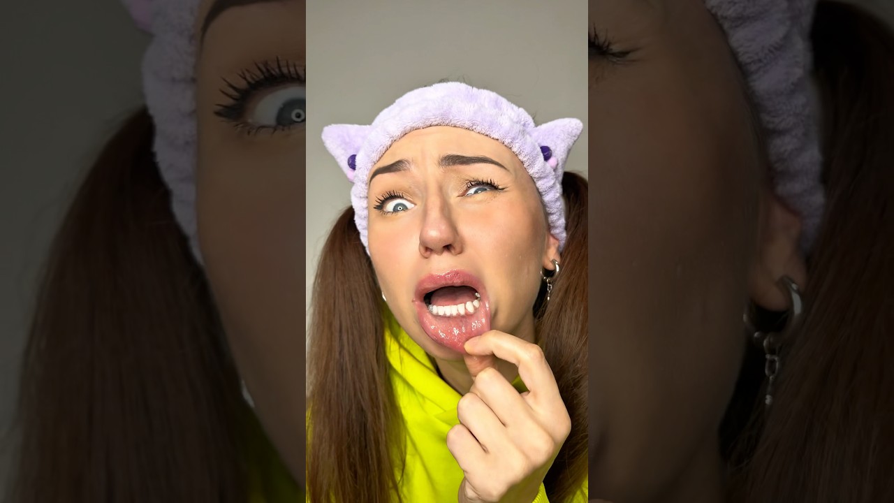 Когда ты случайно прикусил губу🤣 
