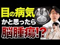 目の病気と間違えやすい怖い病気 眼科医解説 目の病気と間違えやすい怖い病気 眼科医解説