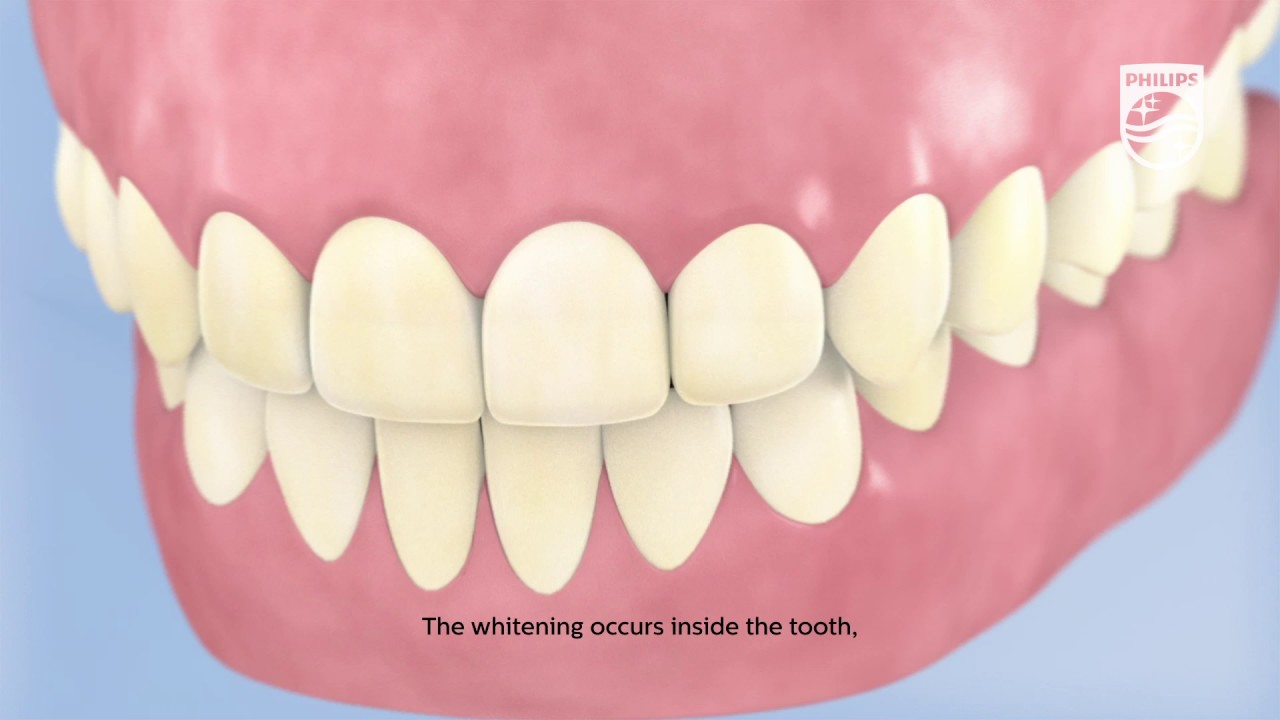 The Science Behind Tooth Whitening animated with subtitles - YouTube