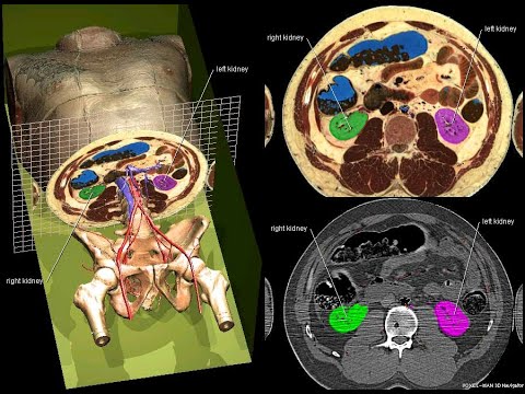 解剖学書籍 HUMAN CROSS-SECTIONAL ANATOMY 値下げ 解剖学書籍 HUMAN CROSS-SECTIONAL ANATOMY 値下げ Cross