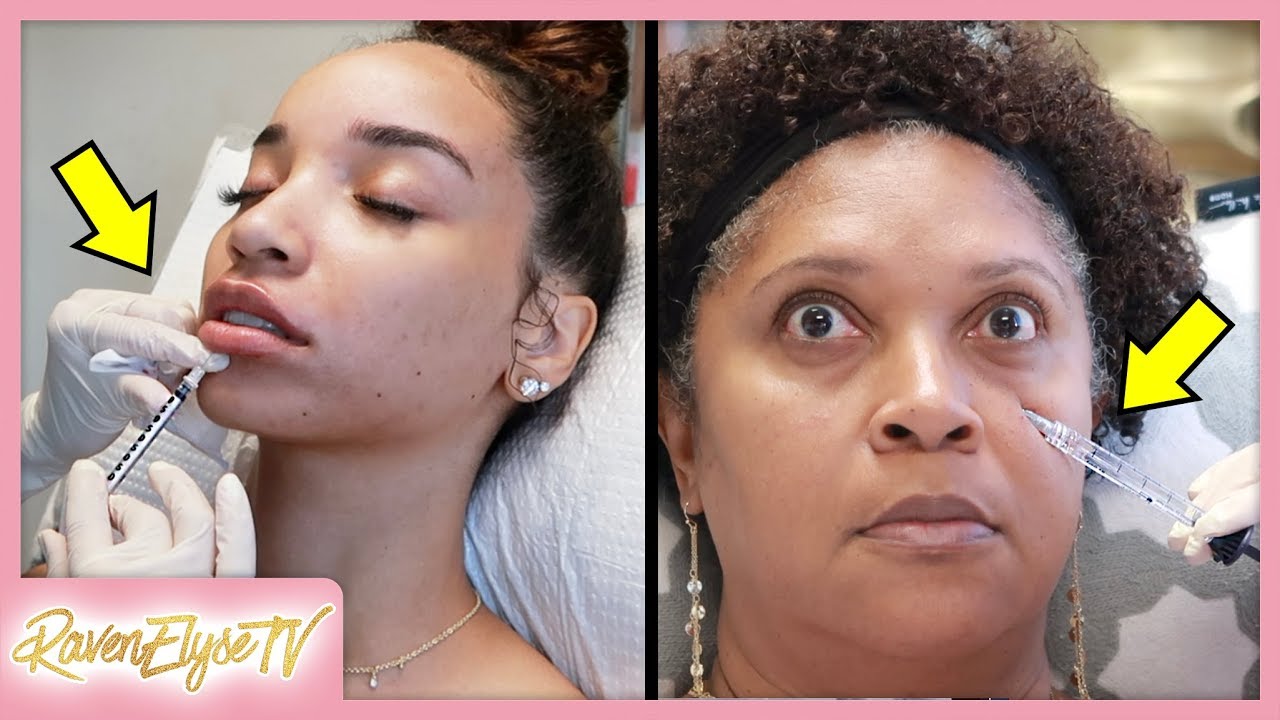 LIP INJECTIONS & UNDER EYE FILLER | Mom & Daughter! mommy vloggers