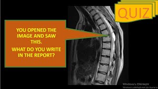 Information RADIOLOGY QUIZ 9 :YOU OPENED THE IMAGE AND SAW THIS.WHAT DO YOU WRITE IN THE REPORT ENJOY WATCHING🌺 Guide