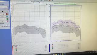 Aurical test box speech mapping 