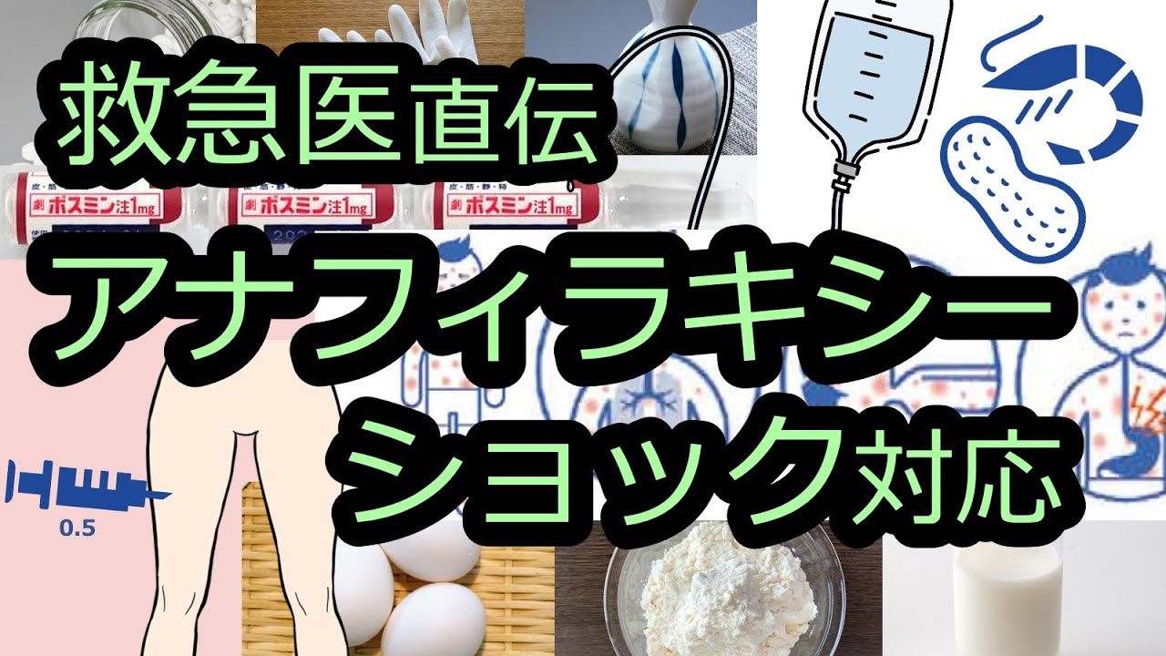 【ショック】アナフィラキシーの診断＆初期対応を徹底解説