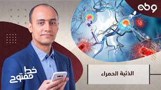 هل للوراثة دور في الإصابة بمرض الذئبة الحمراء؟