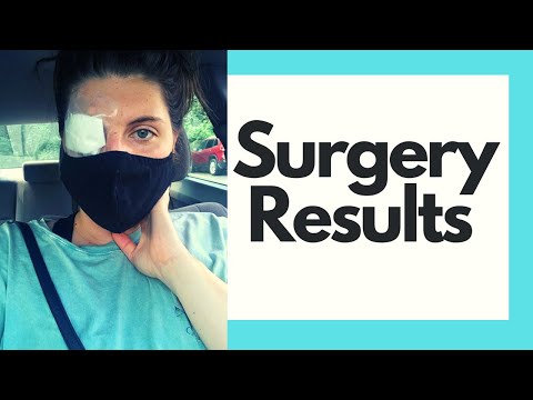 Видео: Chalazion Surgery: что ожидать, последующее лечение, время восстановления и многое другое