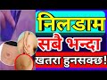 छ ल म द ख न न लड म क ह ब स ल ट क क यस त छ व स तव कत क रण र उपच र यस त छ छ ल म द ख न न लड म क ह ब स ल ट क क यस त छ व स तव कत क रण र उपच र यस त छ