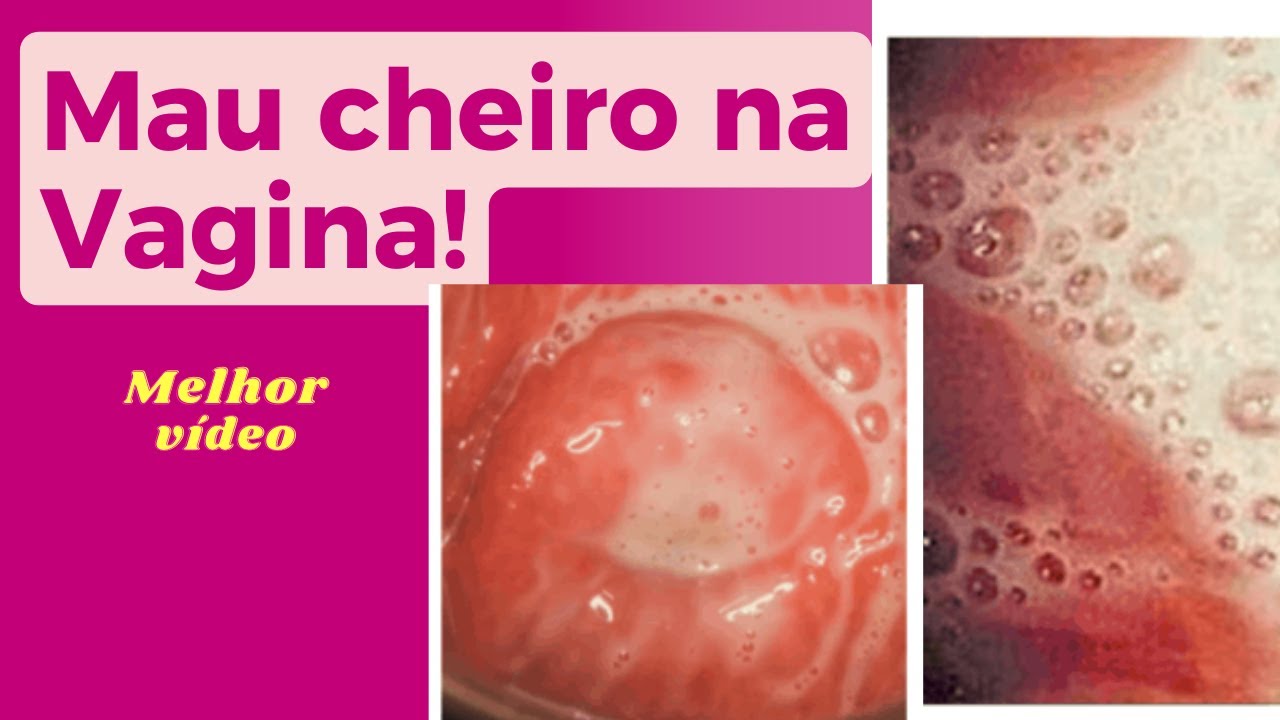 Mau Cheiro na Menstruação 