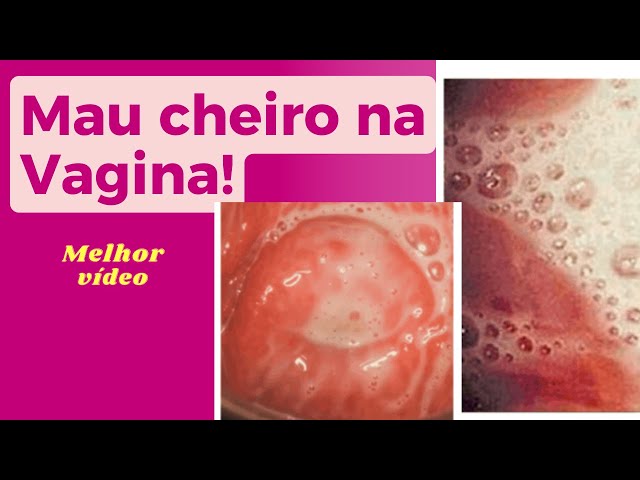 cheiro ruim no final da menstruação