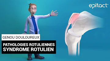 Qu'est-ce que le syndrome rotulien ?