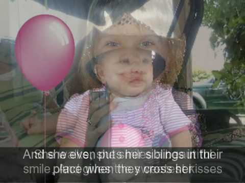 mosaic down syndrome celebrities mosaic down syndrome celebrities