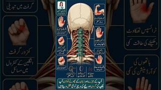 🛑گردن کے درد اور اعصابی کھچاؤ کی اصل وجہ
