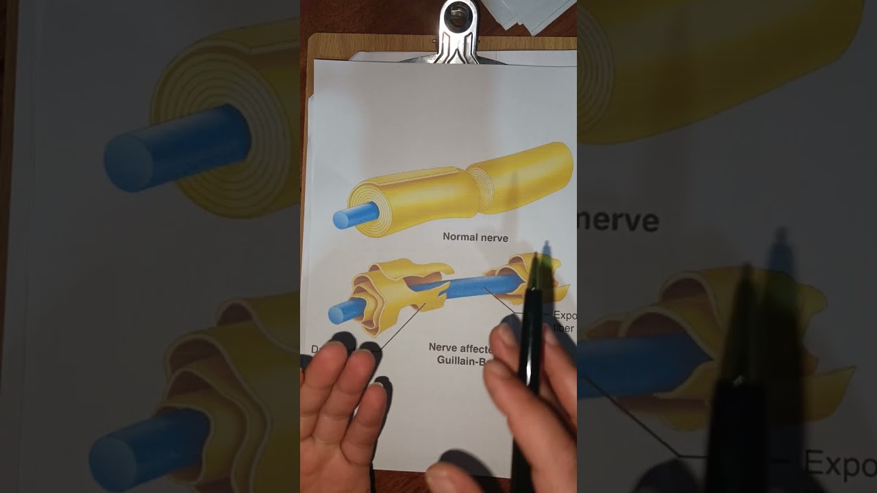 #شرح_وزاري/عنايية/رابعة/L4/ NEUROMUSCULAR WEAKNESS محاضرة رابعة جزء ثاني