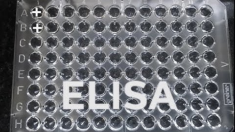 ELISA | How to do ELISA | step by step procedure for ELISA
