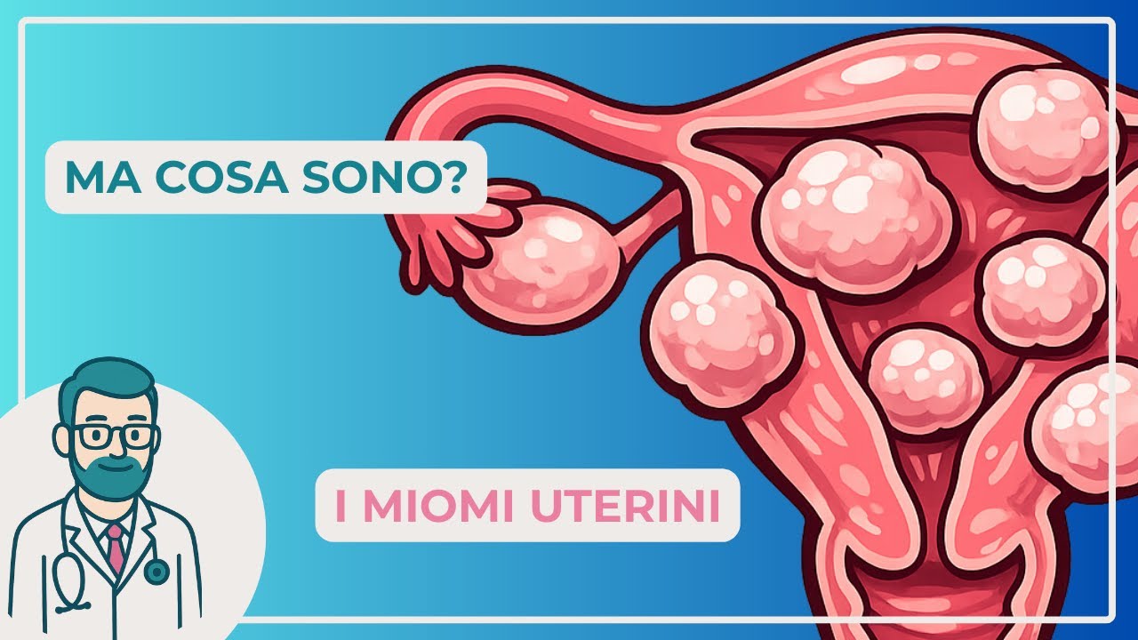 Fibromi? Miomi? Cosa sono davvero?