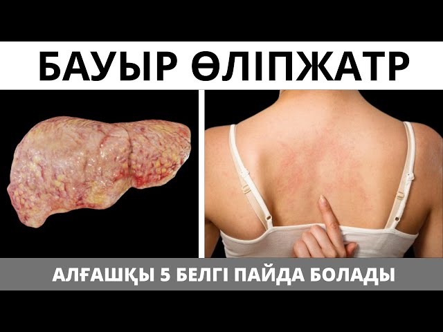 Львовтағы секс әуесқойлары