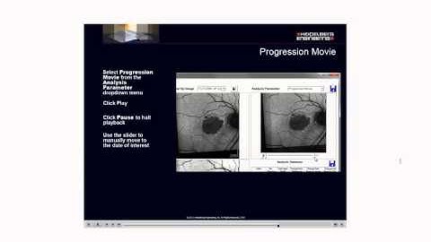 SPECTRALIS RegionFinder