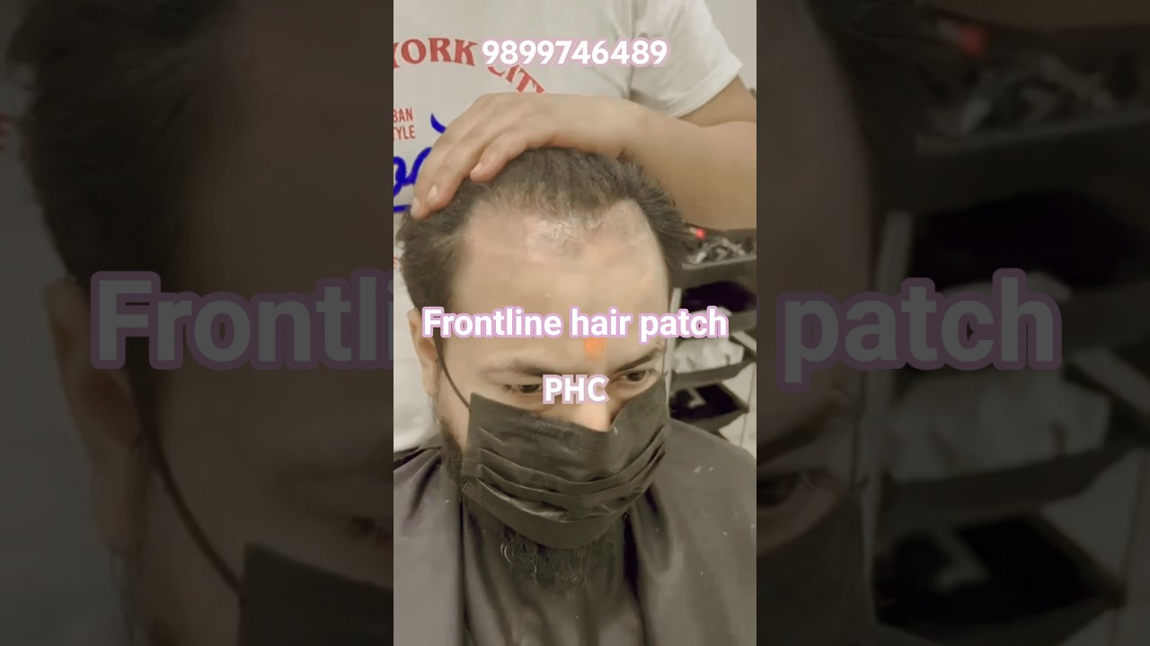 guss Frontline hair patch✨!