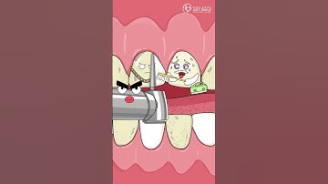 Lấy cao răng định kỳ - Bí quyết cho nụ cười luôn sáng bóng #nhakhoavietsmile #laycaorang