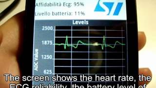 Android ECG2