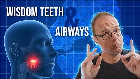 The Hidden Cost of Lost Wisdom Teeth | Airway & Facial Growth Analysis